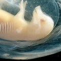 Lần đầu nuôi cấy tim người trong phôi lợn